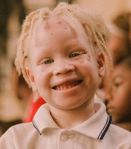 Madagaskar: Rückblick auf einen blutigen Tag nach dem Mord an einem Albino