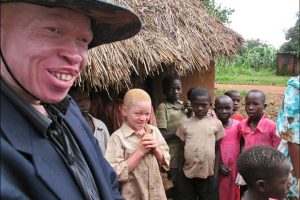 Afrika-Lesetipp/welt-sichten: Albinismus in Uganda - Mit Mut gegen das Stigma